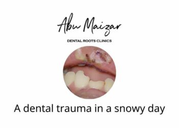 A dental trauma in a snowy day