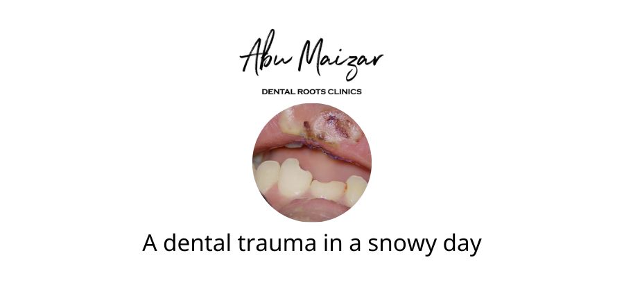 A dental trauma case in a snowy day