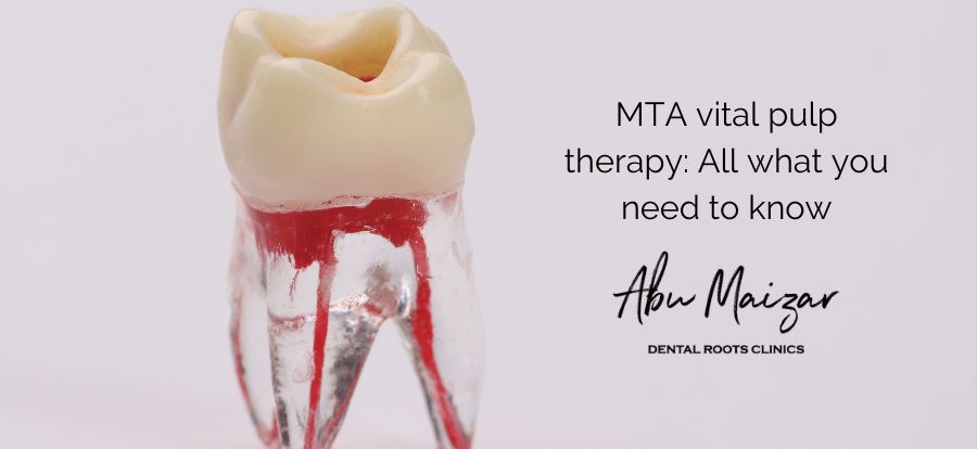 MTA vital pulp therapy