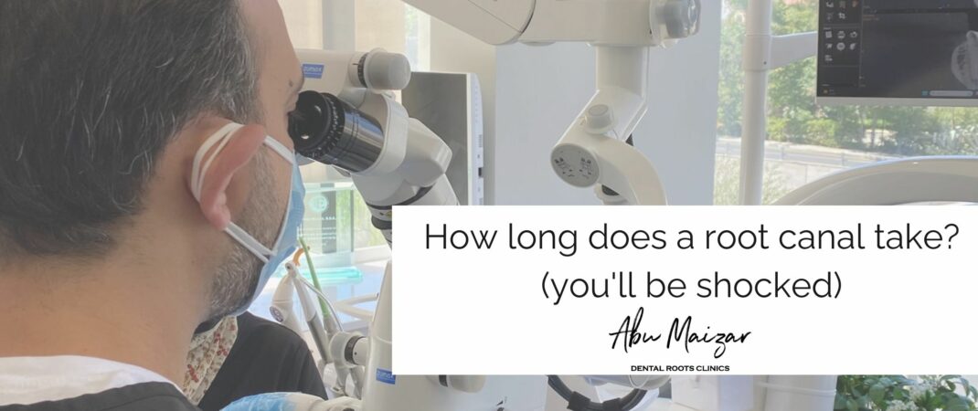 How long does a root canal take?(you'll be shocked) - AbuMaizar Dental  Roots Clinic