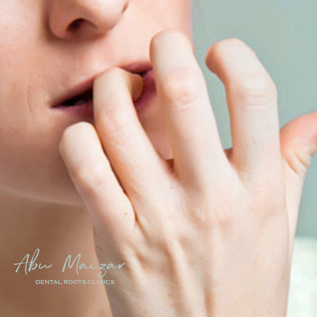 Does Nail Biting Cause Damage To Teeth ? - Abumaizar Dental Roots Clinic