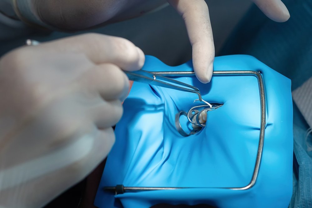 العازل المطاطي للاسنان