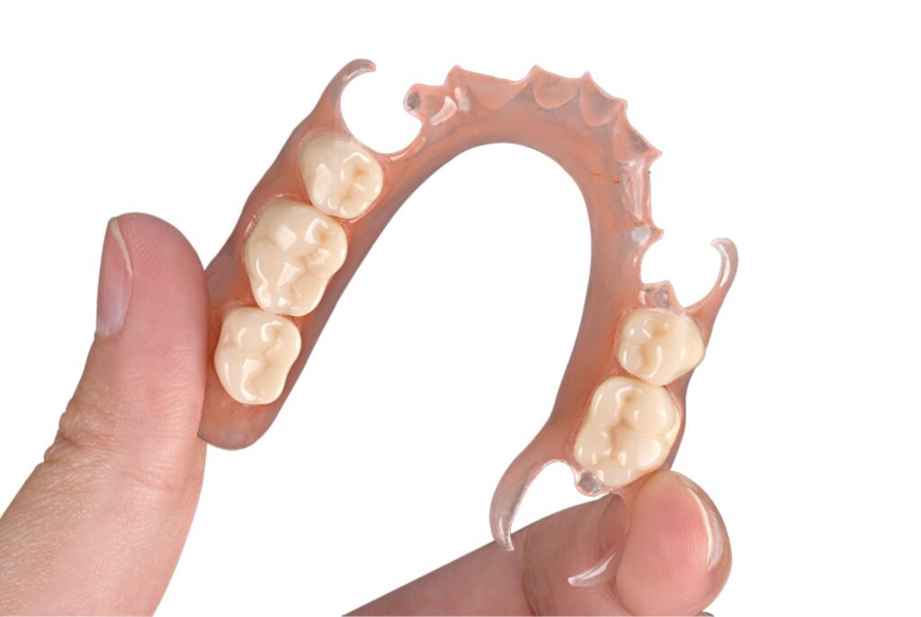 Removable partial denture (RPD) with pink acrylic base and natural-looking replacement teeth