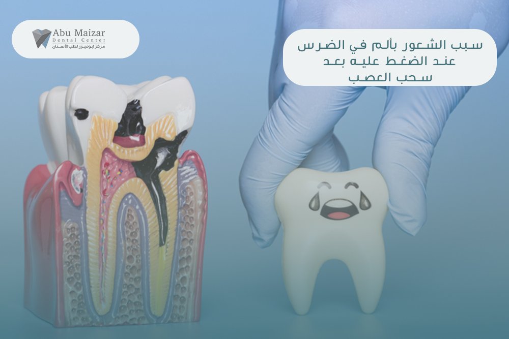 Post-Root Canal Pain