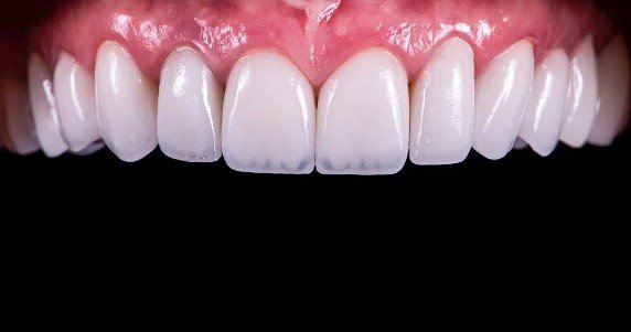 istockphoto-1304372162-170667a