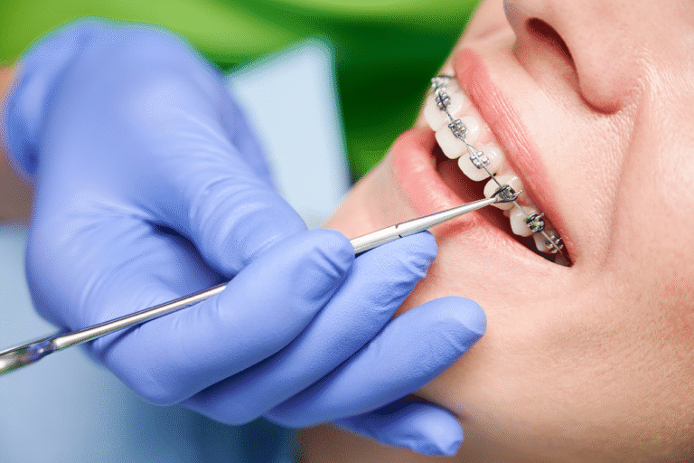 Ortho Treatment